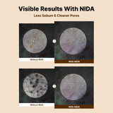 NIDA Baby Face Cleanser Bundle (Set of 4)